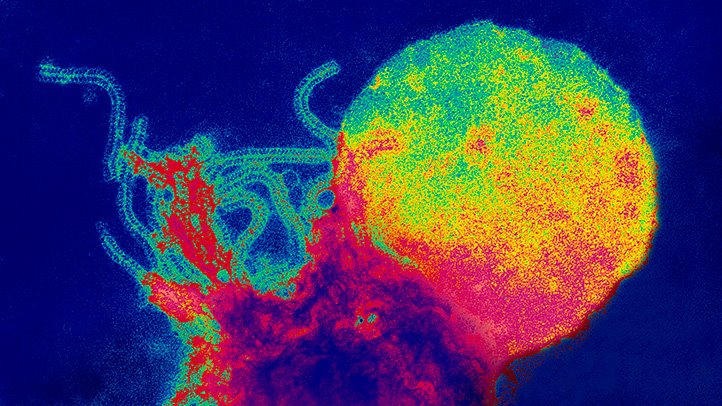 Measles Virus Wipes Out Golf-Ball-Sized Cancer Tumor In 36 Hours