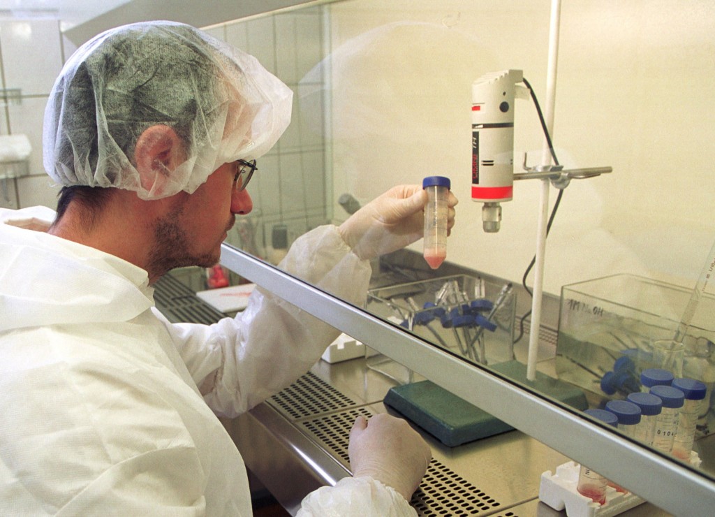 Scientists Claim 40% of Population Infected with “Mind Control Parasite”