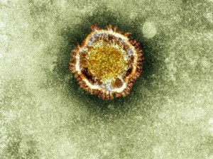 A electron microscope image of a coronavirus is seen in this undated picture provided by the Health Protection Agency in London